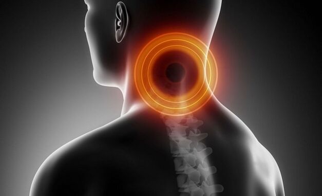 cervicalgie cu osteocondroză cervicală